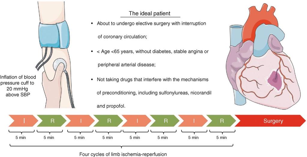 Lancet