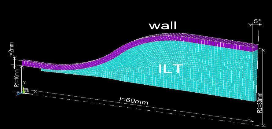 Appendix C: Poroelastic model of ILT in FEA of AAA into at least 180 time steps, when there was a change in the loads.