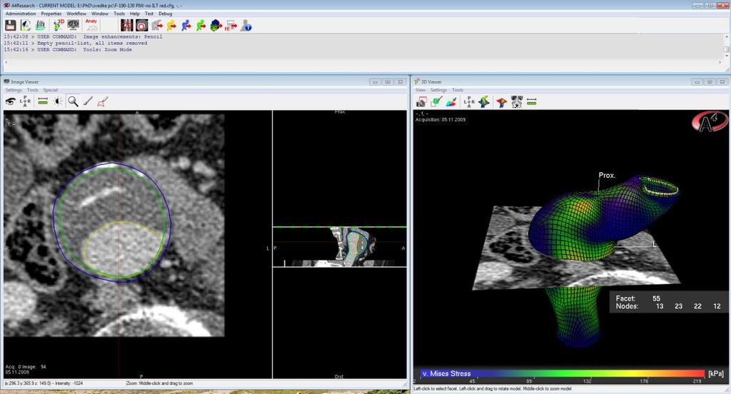 S.Polzer. Stress-strain analysis of aortic aneurysms. Ph.D.Thesis detected.