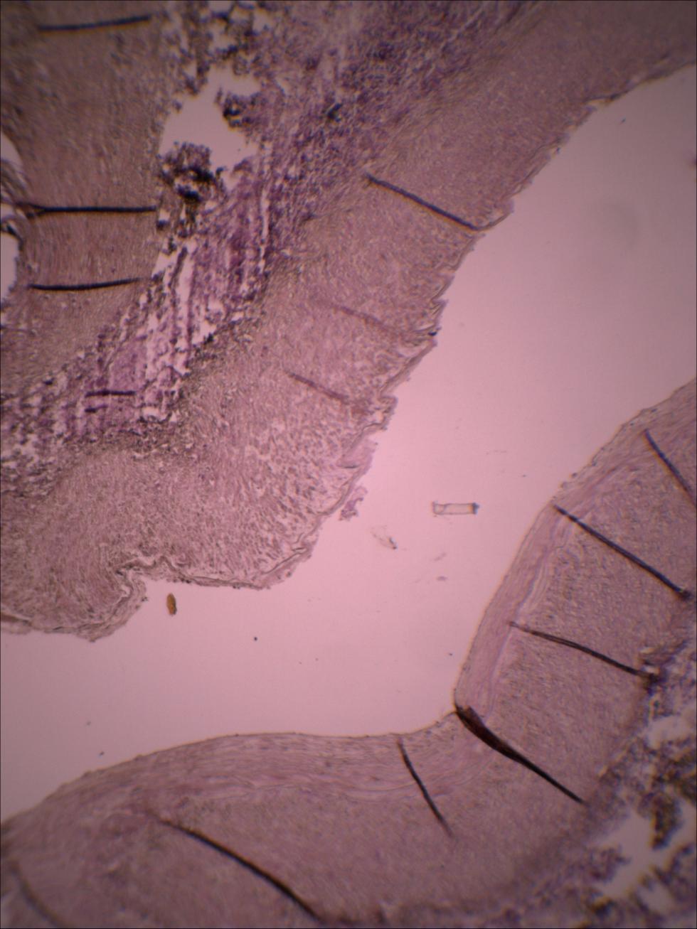 S.Polzer. Stress-strain analysis of aortic aneurysms. Ph.D.Thesis Figure 21 Origin of inferior mesenteric artery passing through the aortic wall. Staining van Gieson. Magnification 20x.