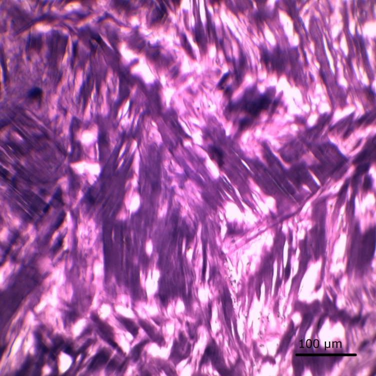 S.Polzer. Stress-strain analysis of aortic aneurysms. Ph.D.Thesis Figure 23 Collagen fibers in the aneurysmal wall. Stained by van Gieson.