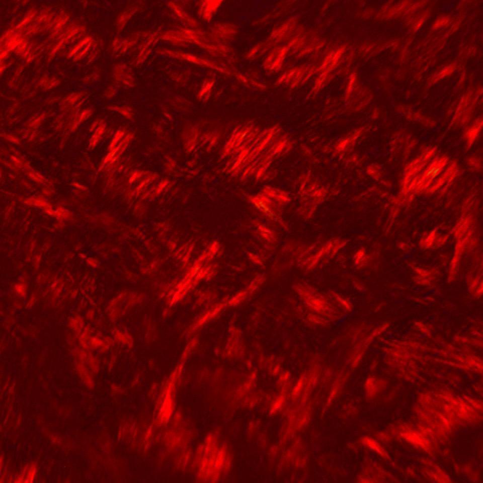 Staining Picrosirius red, magnification 16x 8.2.