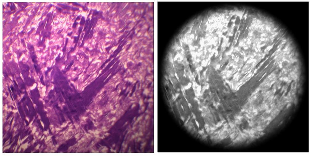 S.Polzer. Stress-strain analysis of aortic aneurysms. Ph.D.Thesis effect of edges while affecting the smallest possible part of the image.