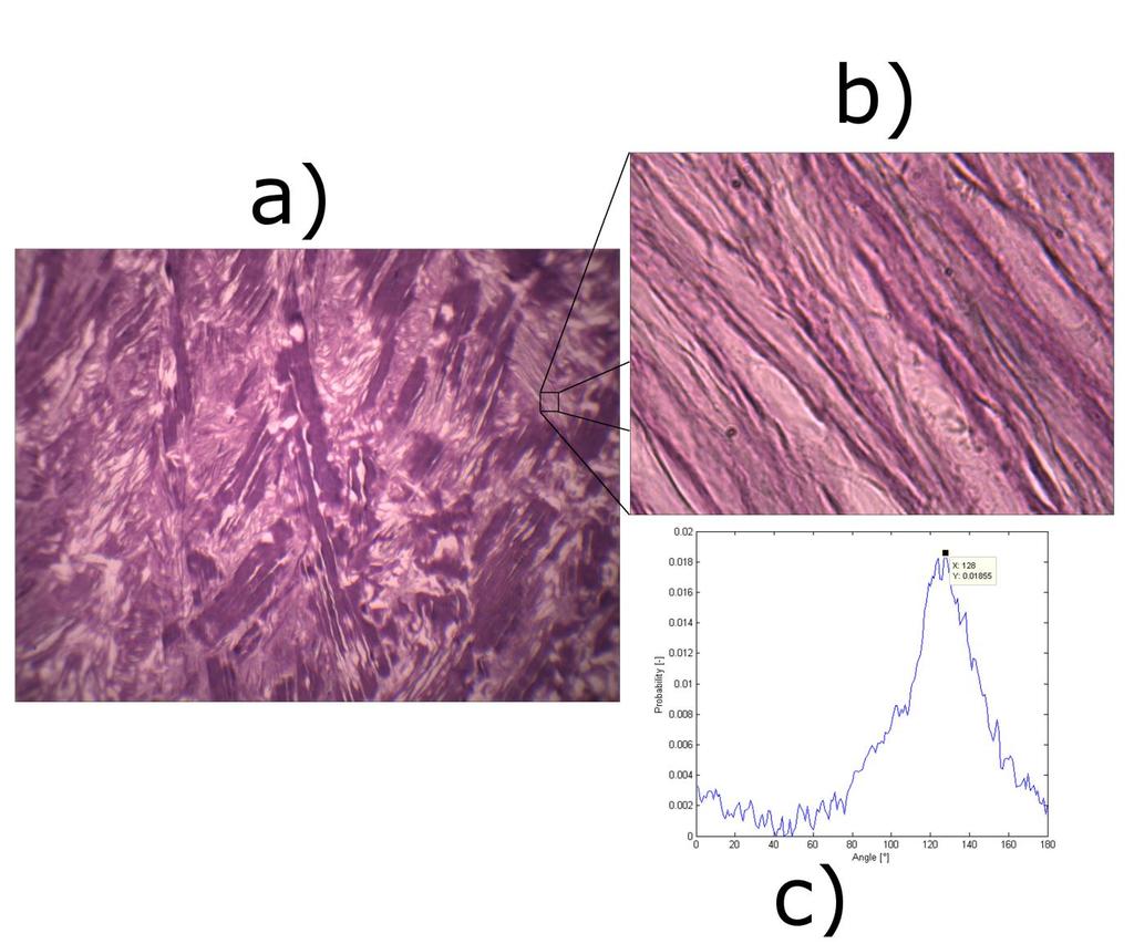 S.Polzer. Stress-strain analysis of aortic aneurysms. Ph.D.Thesis Figure 29 Image analysis process. The analyzed area is captured with magnification 20x (a).