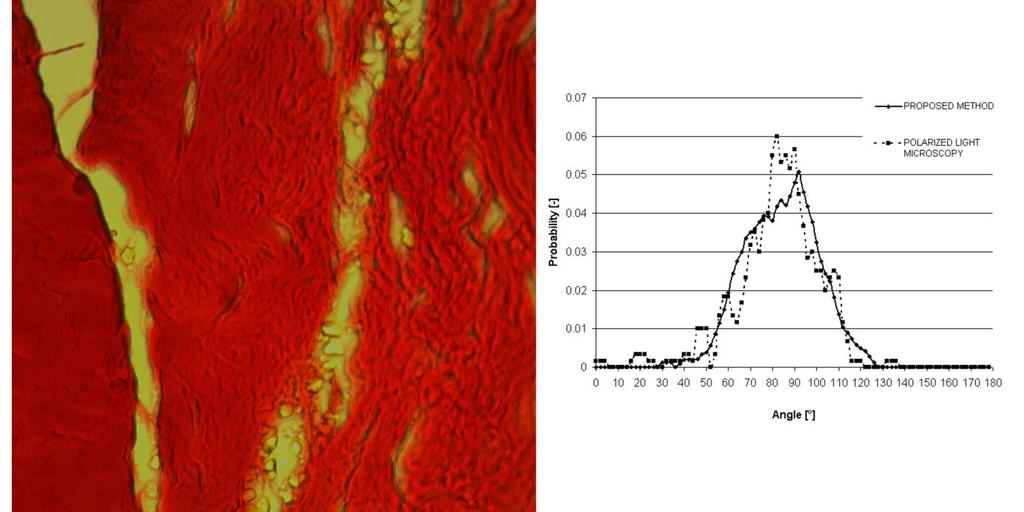 S.Polzer. Stress-strain analysis of aortic aneurysms. Ph.D.