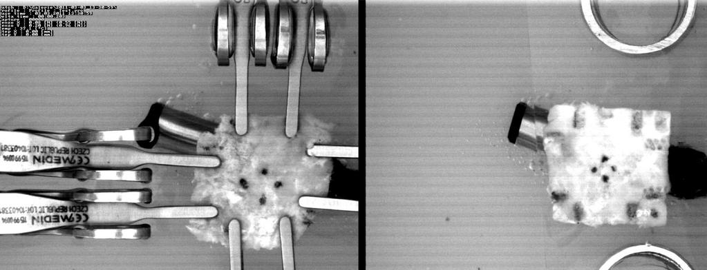 S.Polzer. Stress-strain analysis of aortic aneurysms. Ph.D.Thesis clamping process much faster (see the left image in Figure 33).