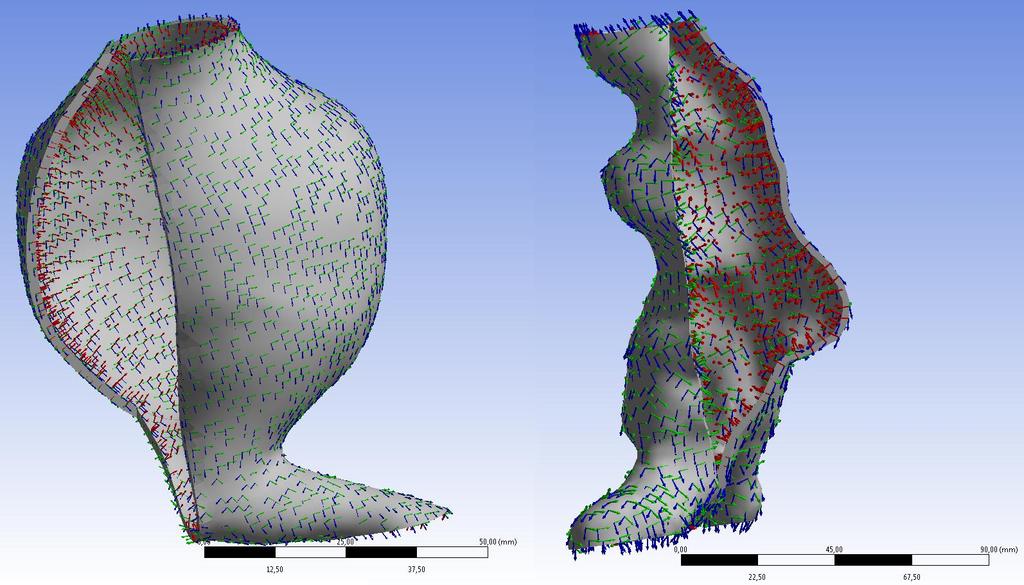 S.Polzer. Stress-strain analysis of aortic aneurysms. Ph.D.