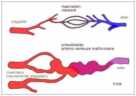 retní sliznici http://www.renduoslerweber.nl/content/3.