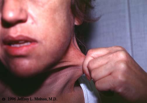 htm http://www.macmed.ttuhsc.