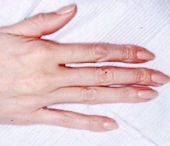 htm http://www.mayoclinic.