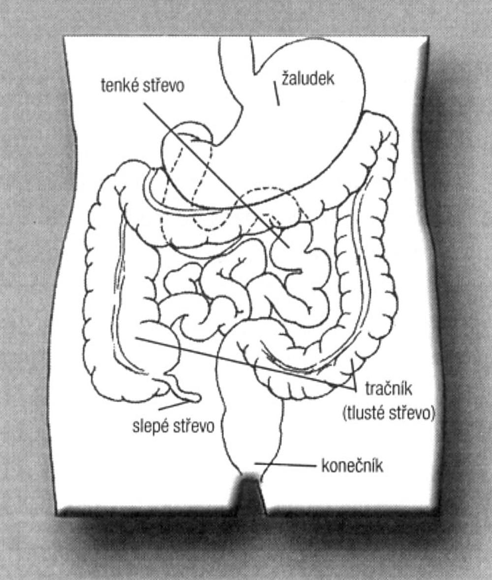 Co je tračník a konečník Tračník (colon) a konečník (rectum) jsou součástí zažívacího ústrojí. Tlusté střevo tvoří dlouhou, svalovou trubici, která měří přibližně 130-150cm.