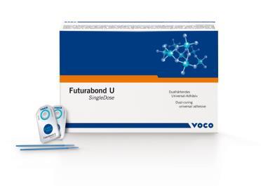 Ultra Etch 35% kyselina fosforecná pro ideální leptání, unikátní samolimitující chemie Peak Universal Bond Jednoduchý. Spolehlivý.