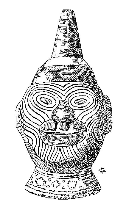 3. TEORETICKÁ ČÁST 3.1 Historie léčby rozštěpových vad obličeje Rozštěpová vada obličeje provází lidstvo od jeho prvopočátků.