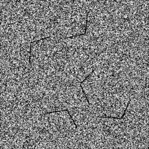 (a) (b) (c) (d) Obr. 3.1: Vytvořené syntetické testovací obrazy karbonových nanokuželů.
