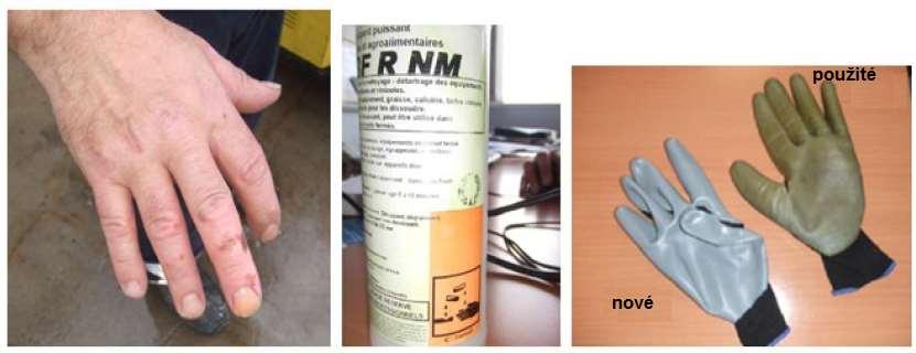 Údržba lahví poleptání chemikálií úraz s