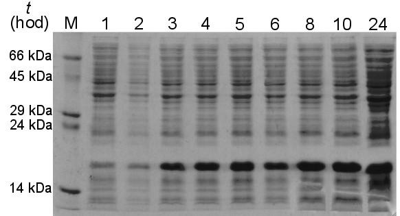 5.4 Optimalizace produkce V tomto kroku byla provedena optimalizace produkce rnkr-p1a podle postupu v kap. 4.5. Byly optimalizovány 3 parametry: koncentrace induktoru IPTG, teplota a doba produkce.