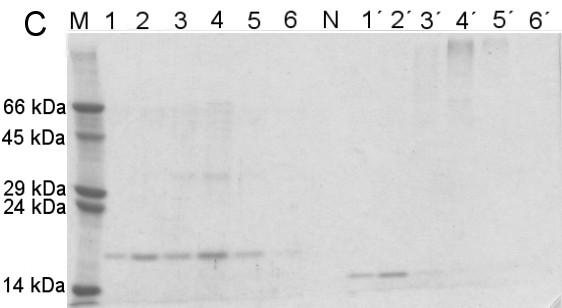 Obr. 9: SDS-PAGE frakcí po chromatografii na Q Sepharose FF.