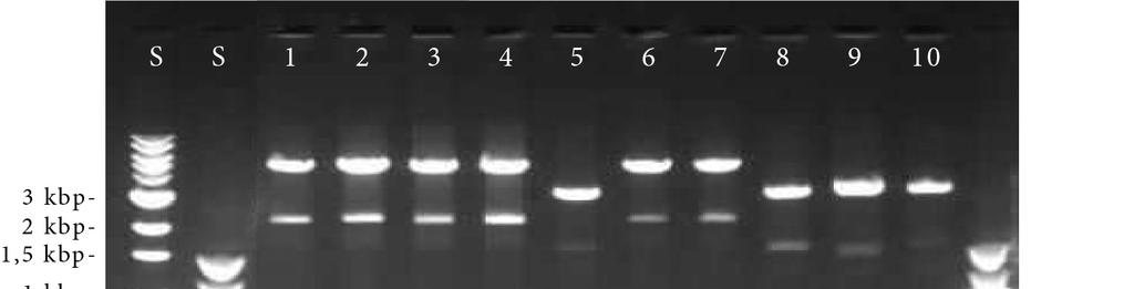 Obr. 15 Výsledek PCR amplifikace, očekávaná délka produktu 381 bp.