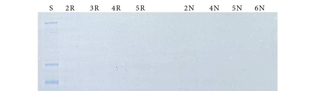 3,4 2,9 2,4 A280 1,9 1,4 1 2 3 4 5 0,9 0,4-0,1 0 10 20 30 40 50 60 t [min] Obr.