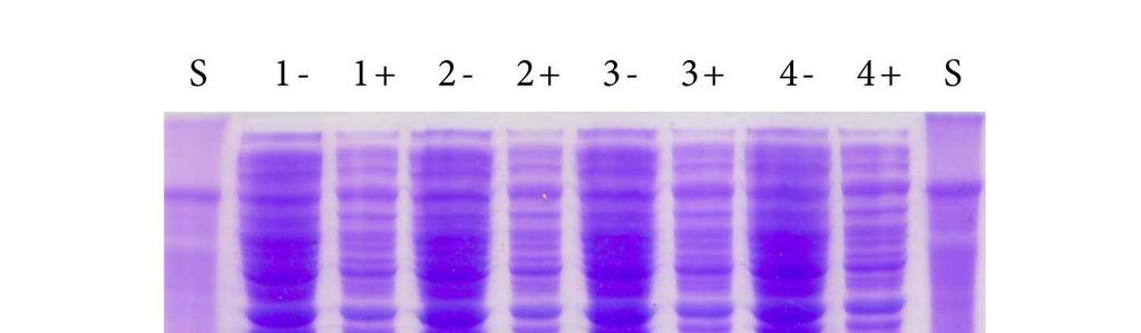 5.4 Příprava proteinu hnkr-p1a Q80 5.4.1 Produkce proteinu Produkce proteinu probíhala v kultuře E. coli BL21 CodonPlus (DE3) RIPL.