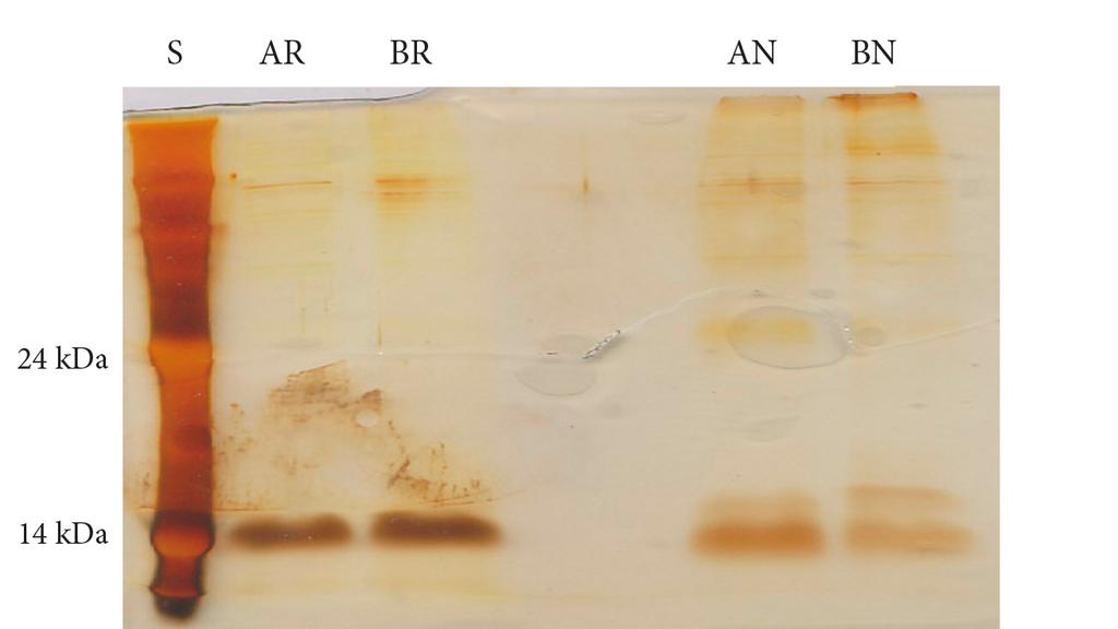 byla připojena na HPLC systém Biosys 510, byla promyta pufrem B (15 mm Tris-HCl, 1 M NaCl, 1 mm NaN 3, ph 9,0) a následně pufrem A (15 mm Tris-HCl, 50 mm NaCl, 1 mm NaN 3, ph 9,0).