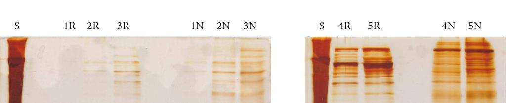 Nejlepší výsledek po ionexové chromatografii vykázal vzorek A. Jímané frakce viz. obr.
