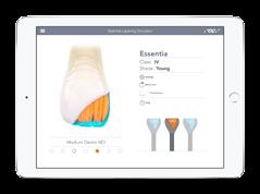 Endo Bonding & DokonËení & leštêní Sejmutí otisku & vytvoõení modelu Modelování Pryskyõice / Vosk Lisování Lab skenování & CAD CAM konstrukce OrdinaËní CAM Intraorální skenování Objevte sílu vláken