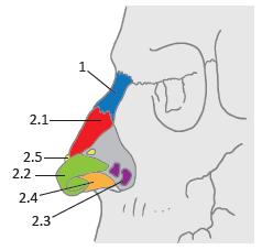 Vzor tumor - příklady Nosní chrupavky (dosl.