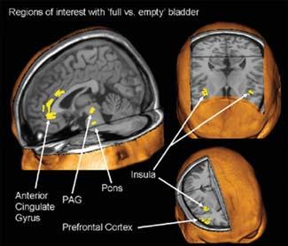 Obrázek 2 Vyšší centra funkčně související s aktivací pontinního centra při plnící a vyprazdňovací fázi (Fowler, 2006) Překlad použitých výrazů: regions of interest with full vs.