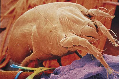 House dust mite (HDM) Roztoč