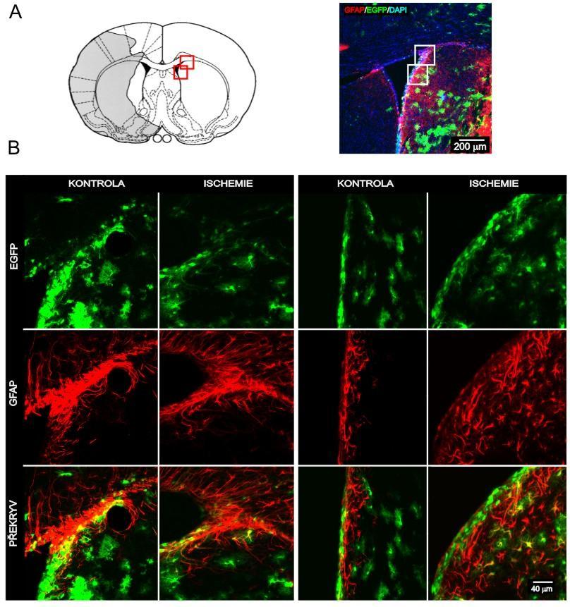 Na základě této analýzy lze říci, ţe po MCAO dochází k neurogenezi v SVZ ve zvýšené míře.