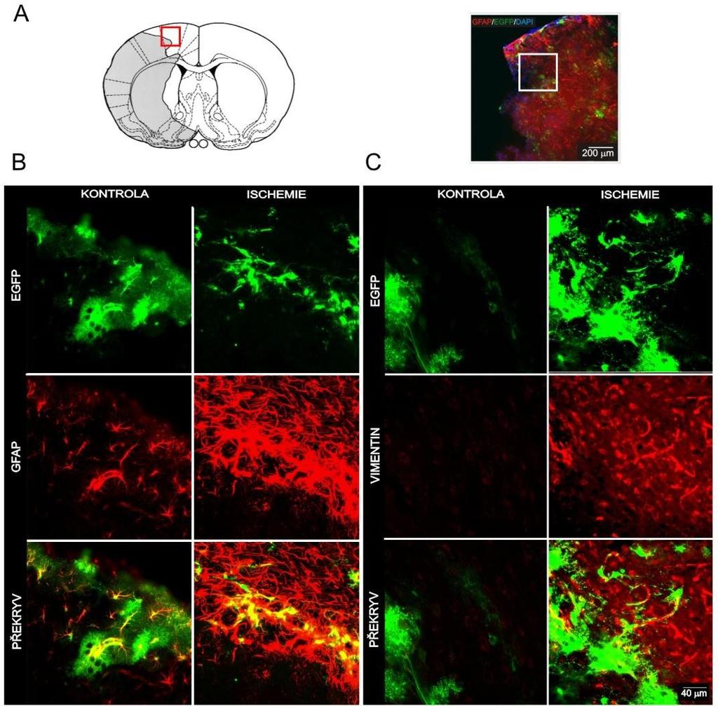 5.1.2. Změna gliogeneze v mozkové kůře Další oblast, která byla imunohistologicky analyzována je mozková kůra na rozhraní ischemické léze a nepoškozené tkáně (viz obr. 19 A).