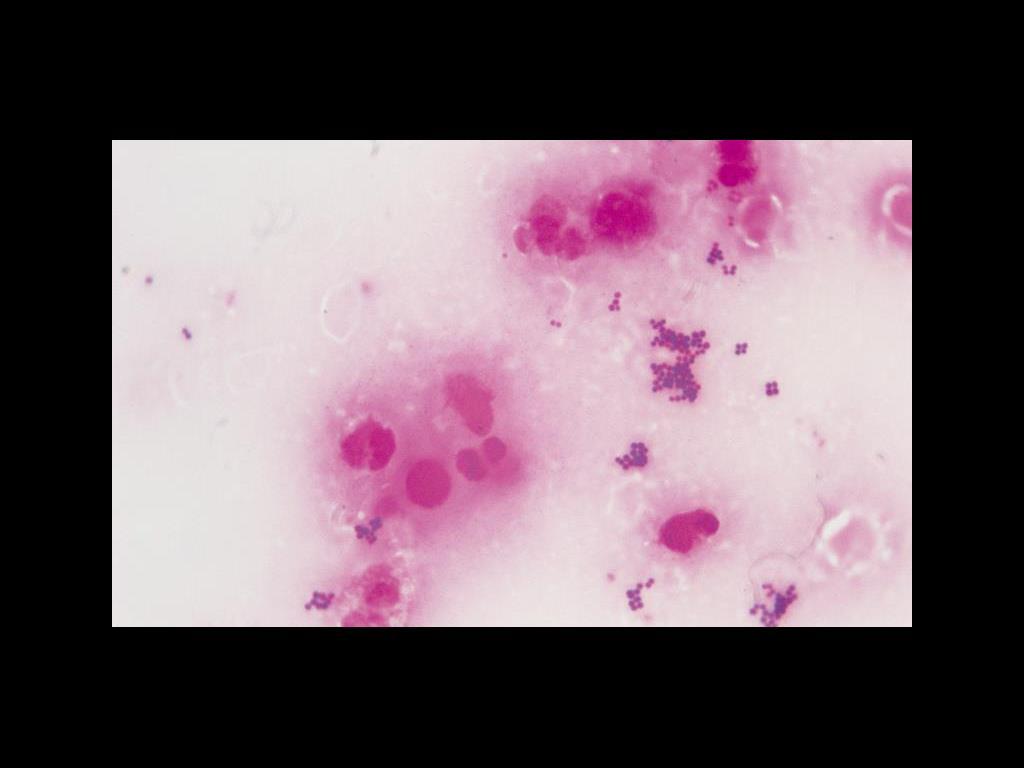 Staphylococcus