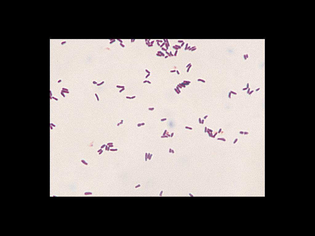 Corynebacterium spp.