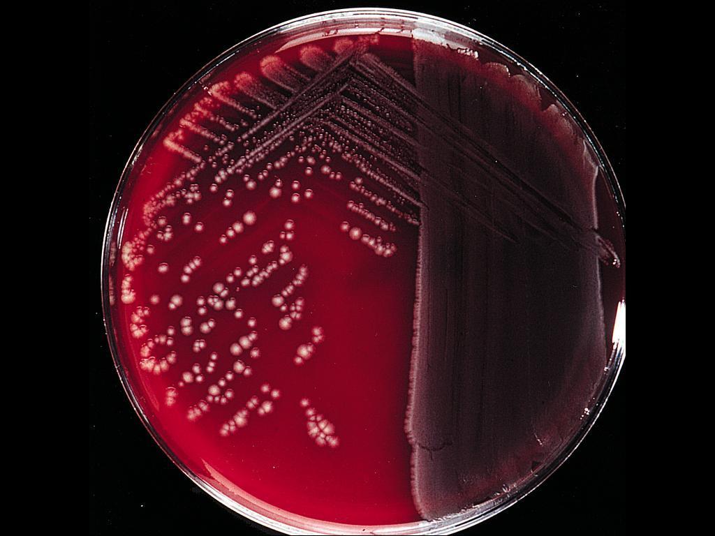 Mixed culture of two morphotypes of Enterobacteriaceae