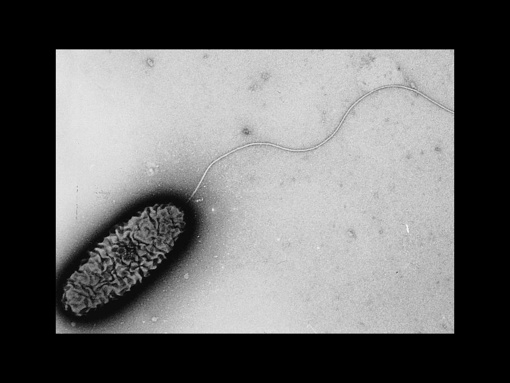 Pseudomonas aeruginosa monotrichous