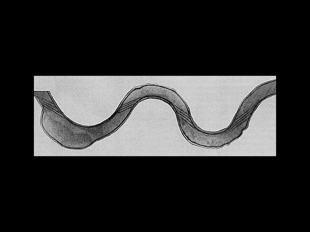 Helical structure of Treponema