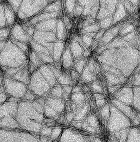 Amyloid fibrils elongated nanoscale structures Amyloid fibril formation by proteins and polypeptides: Well-known amyloid-associated disease - Alzheimer s disease, in which the β-amyloid polypeptide