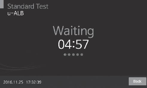 Ihned po napipetování vzorku stlačte tlačítko START. 12. Po 5 minutách analyzátor automaticky zobrazí výsledek.