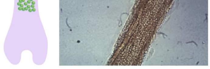 Microsporum: M. canis, M. audouinii, M.