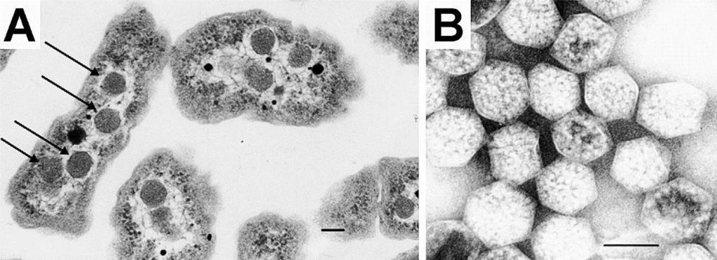 KARBOXYZÓMY (POLYHEDRAL BODIES) tvar mnohostěnu