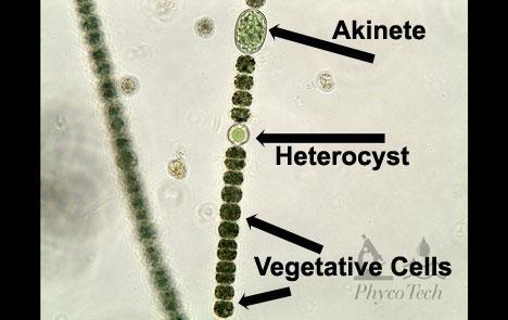 AKINETY ještě větší než heterocyty vznik z