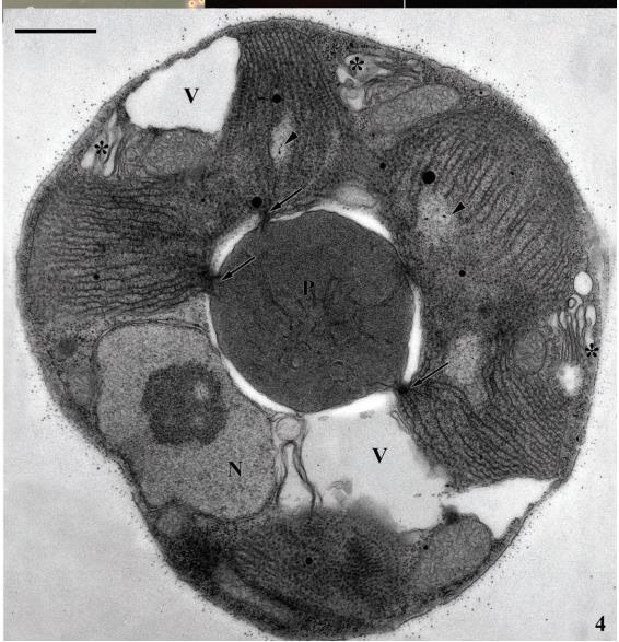 Medial section showing peripheral nucleus (N) with prominent nucleolus.