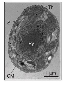 Transmission electron microscopy image of a P.