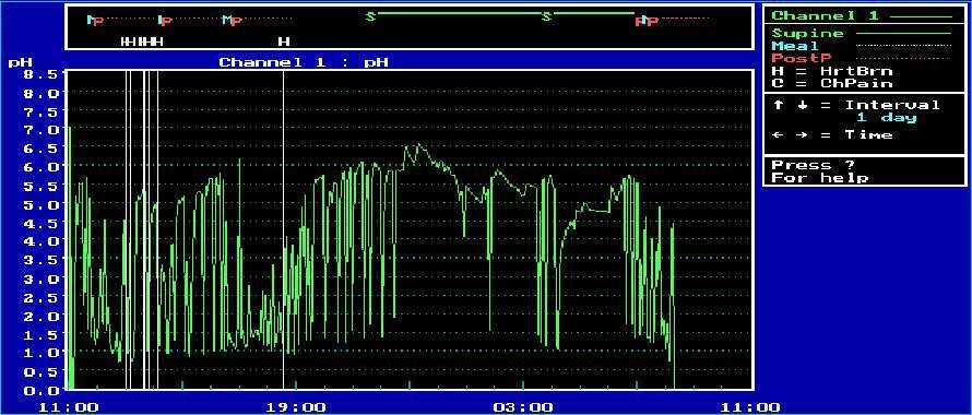 typické symptomy + atypické symptomy +