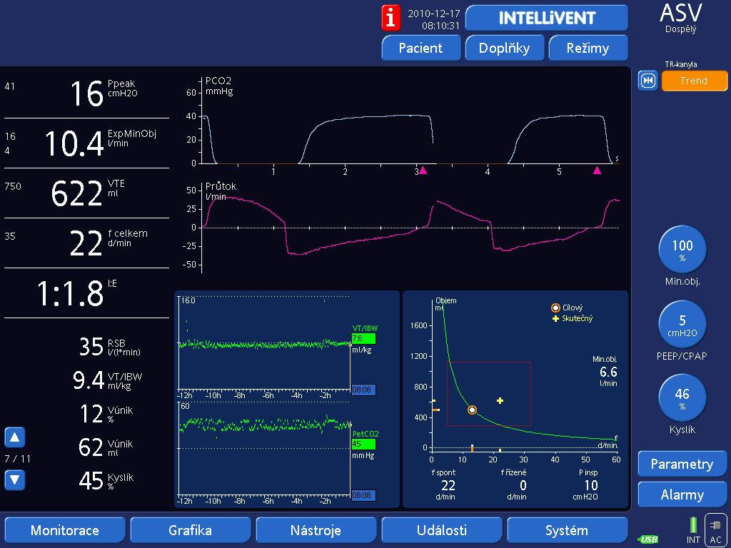 Ventilation (100 ml/kg/min )