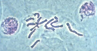 Chromosomy v rostlinné systematice (20. stol.