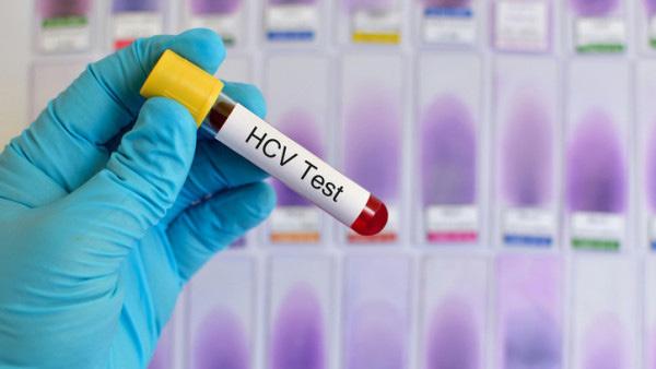 Výskyt žloutenky typu C u HIV pozitivních mužů v Londýně klesl o 70% Výzkumný tým analyzoval údaje 6000 HIV pozitivních mužů ohrožených akutní žloutenkou typu C.