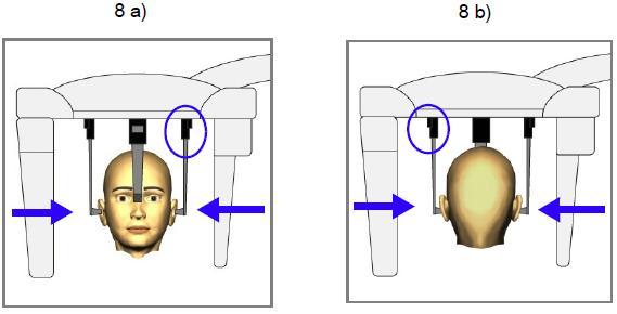 8. Umístěte pacienta mezi dvě ušní opěrky tak, aby a) byl tváří směrem od stěny ANEBO b) tváři směrem ke stěně 9. Uvolněte opěrku ucha po levé ruce a velmi opatrně jí vsuňte do ušního otvoru pacienta.