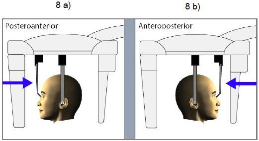 8. Umístěte pacienta mezi dvě ušní opěrky tak, aby a) při posterior-anteriórní expozici se pacient dívá na senzor b) při anterior-posteriorním snímkování se musí pacient dívat směrem na kolimátor 9.